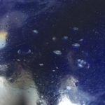 example of enamel defect called fishscaling